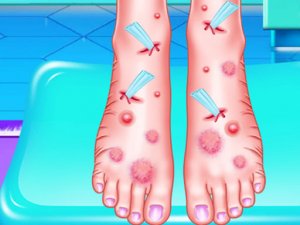 Emma Foot Treatment Online Game - Caring Game